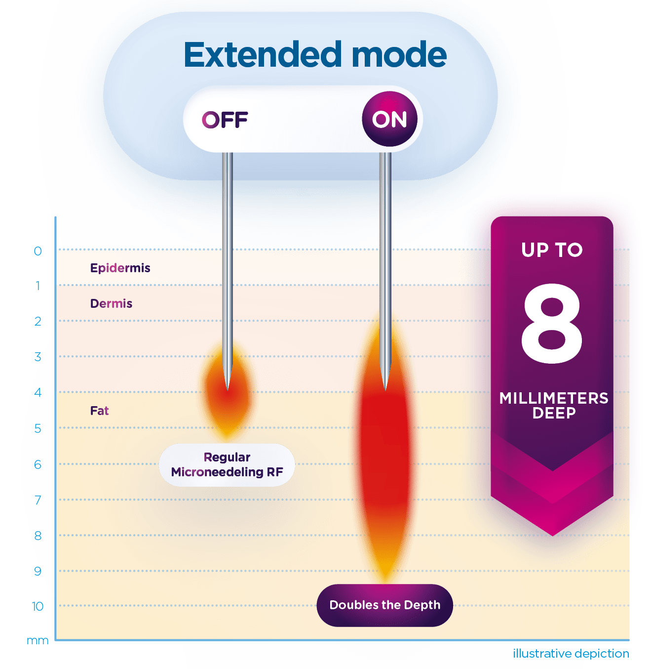 Exion Microneedling Extended Mode